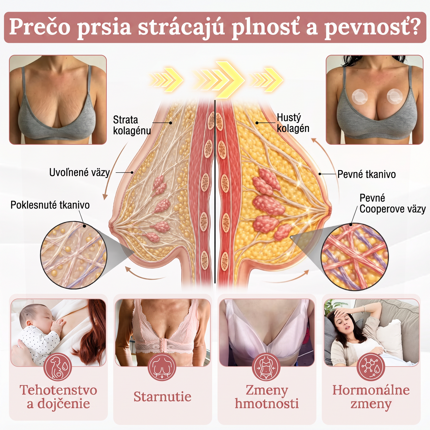 🎁🎁🎁 Posledných 10 balení 𝐻𝐼𝑆𝐾𝐼𝑁®! Teraz extra 50 % zľava. Podporte plnší pevnejší a pozdvihnutejší vzhľad poprsia a získajte späť sebavedomie. Nezmeškajte to – ďalšia akcia môže byť až o rok! 💖
