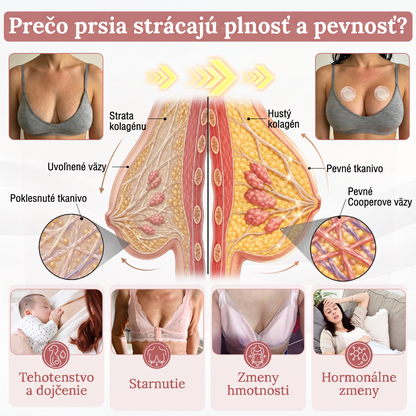 🎁🎁🎁 Posledných 10 balení 𝐻𝐼𝑆𝐾𝐼𝑁®! Teraz extra 50 % zľava. Podporte plnší pevnejší a pozdvihnutejší vzhľad poprsia a získajte späť sebavedomie. Nezmeškajte to – ďalšia akcia môže byť až o rok! 💖