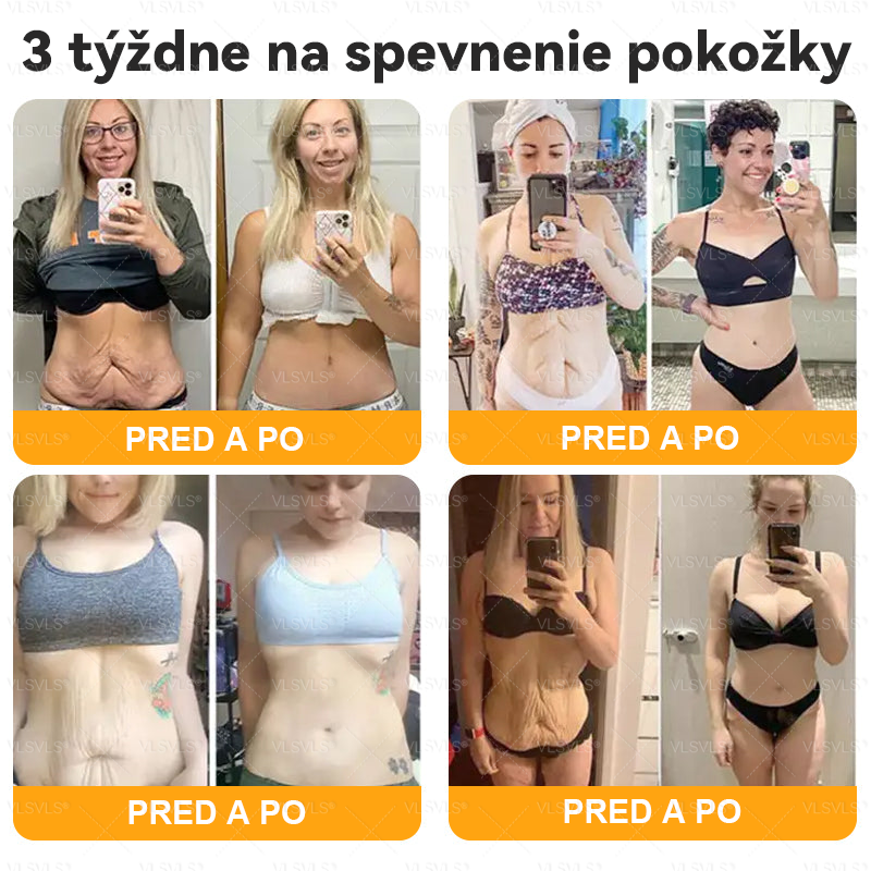🌸🌸  VLSVLS® Komplexný krém s včelím jedom – POSLEDNÝ DEŇ: Zľava 80 %! (ochabnutá pokožka, jemné vrásky, strata pevnosti, ploché poprsie, ovisnuté boky a ďalšie)