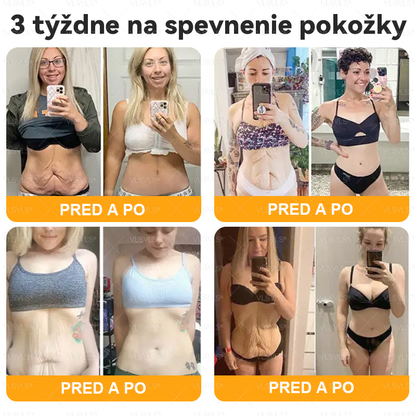 🌸🌸  VLSVLS® Komplexný krém s včelím jedom – POSLEDNÝ DEŇ: Zľava 80 %! (ochabnutá pokožka, jemné vrásky, strata pevnosti, ploché poprsie, ovisnuté boky a ďalšie)