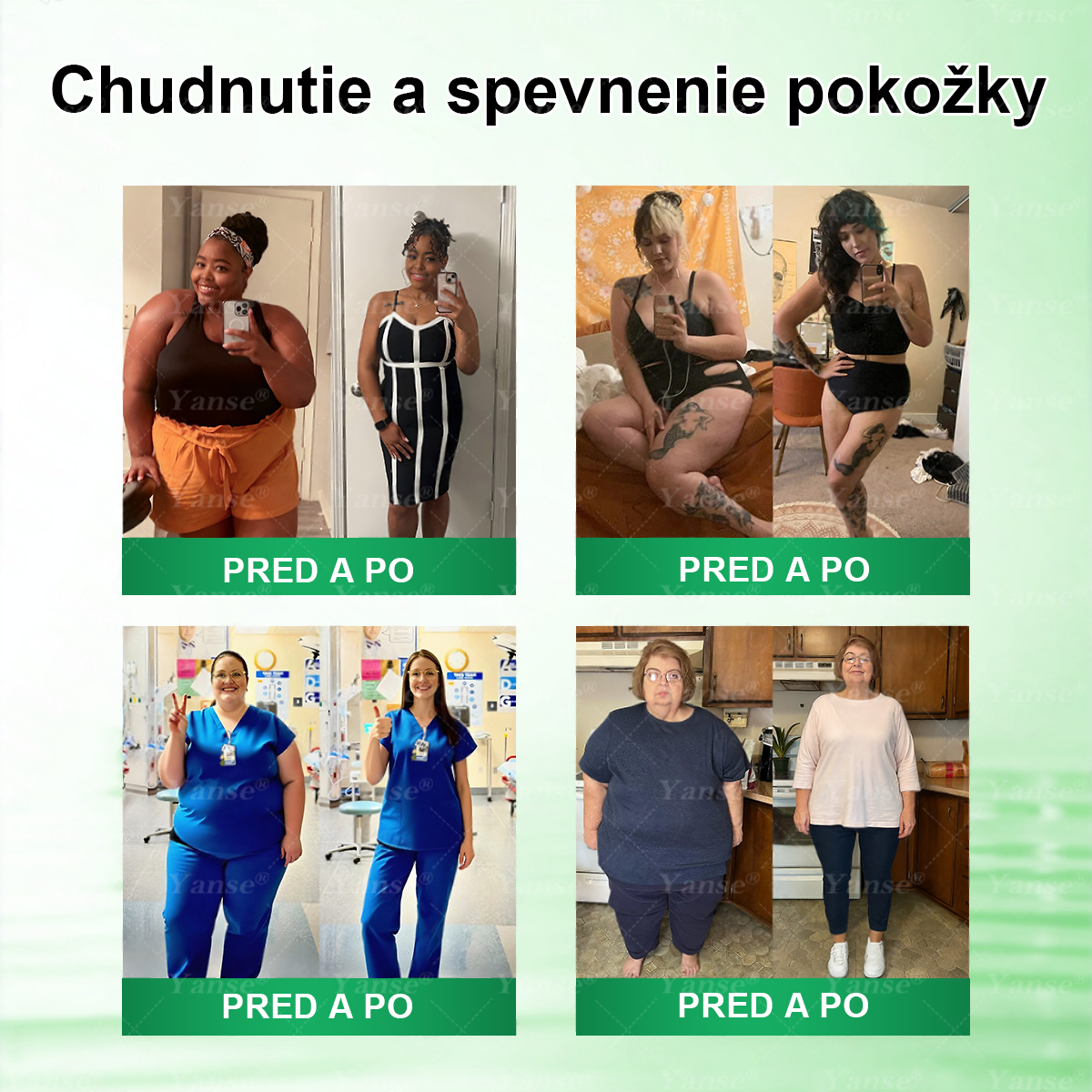 Oficiálny e-shop | 🎈𝐘𝐚𝐧𝐬𝐞® 𝑴𝒐𝒓𝒊𝒏𝒈𝒂 · 𝘽𝙚𝙧𝙗𝙚𝙧í𝙣 × 𝑵𝑨𝑫 + 𝐍𝐚𝐧𝐨 𝒎𝒊𝒌𝒓𝒐𝒊𝒉𝒍𝒊č𝒌𝒐𝒗á 𝙣á𝙥𝙡𝙖𝙨ť 𝙣𝙖 𝒑𝒐𝒅𝒑𝒐𝒓𝒖 𝐜𝐡𝐮𝐝𝐧𝐮𝐭𝐢𝐚 𝐚 𝙯𝙙𝙧𝙖𝙫𝙞𝙖 𝒕𝒓á𝒗𝒊𝒂𝒄𝒆𝒉𝒐 𝐬𝐲𝐬𝐭é𝐦𝐮🇸🇰 (Stačí raz denne — prvé viditeľné zmeny už po 7 dňoch) ✅ Komplexná podpora formovania postavy