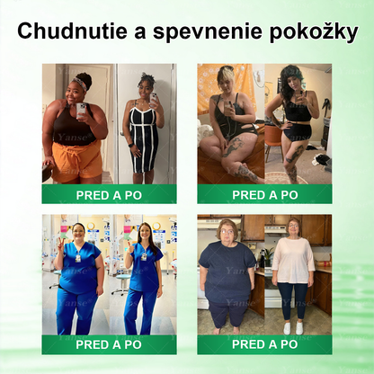 Oficiálny e-shop | 🎈𝐘𝐚𝐧𝐬𝐞® 𝑴𝒐𝒓𝒊𝒏𝒈𝒂 · 𝘽𝙚𝙧𝙗𝙚𝙧í𝙣 × 𝑵𝑨𝑫 + 𝐍𝐚𝐧𝐨 𝒎𝒊𝒌𝒓𝒐𝒊𝒉𝒍𝒊č𝒌𝒐𝒗á 𝙣á𝙥𝙡𝙖𝙨ť 𝙣𝙖 𝒑𝒐𝒅𝒑𝒐𝒓𝒖 𝐜𝐡𝐮𝐝𝐧𝐮𝐭𝐢𝐚 𝐚 𝙯𝙙𝙧𝙖𝙫𝙞𝙖 𝒕𝒓á𝒗𝒊𝒂𝒄𝒆𝒉𝒐 𝐬𝐲𝐬𝐭é𝐦𝐮🇸🇰 (Stačí raz denne — prvé viditeľné zmeny už po 7 dňoch) ✅ Komplexná podpora formovania postavy
