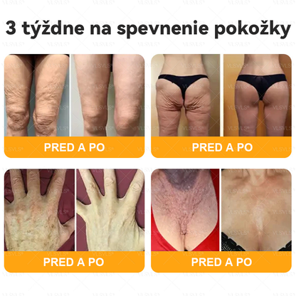 🌸🌸  VLSVLS® Komplexný krém s včelím jedom – POSLEDNÝ DEŇ: Zľava 80 %! (ochabnutá pokožka, jemné vrásky, strata pevnosti, ploché poprsie, ovisnuté boky a ďalšie)