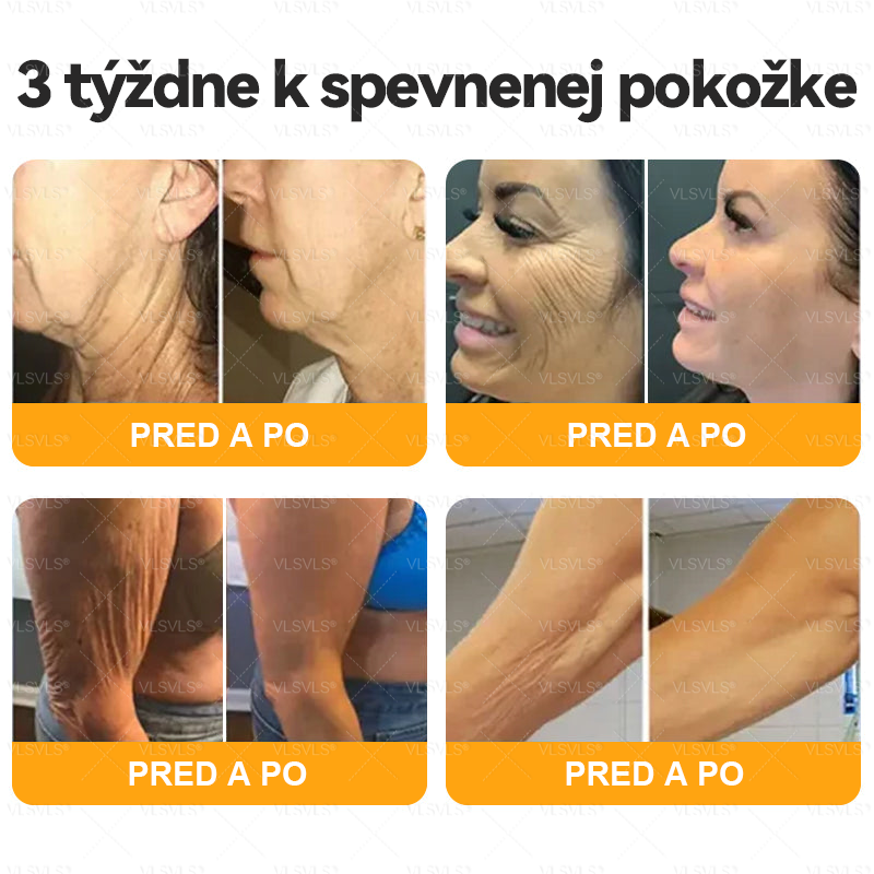 🌸🌸  VLSVLS® Komplexný krém s včelím jedom – POSLEDNÝ DEŇ: Zľava 80 %! (ochabnutá pokožka, jemné vrásky, strata pevnosti, ploché poprsie, ovisnuté boky a ďalšie)