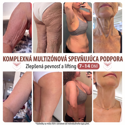 💦HISKIN® Náplasti s mikroihličkami na zväčšenie objemu, spevnenie a lifting poprsia