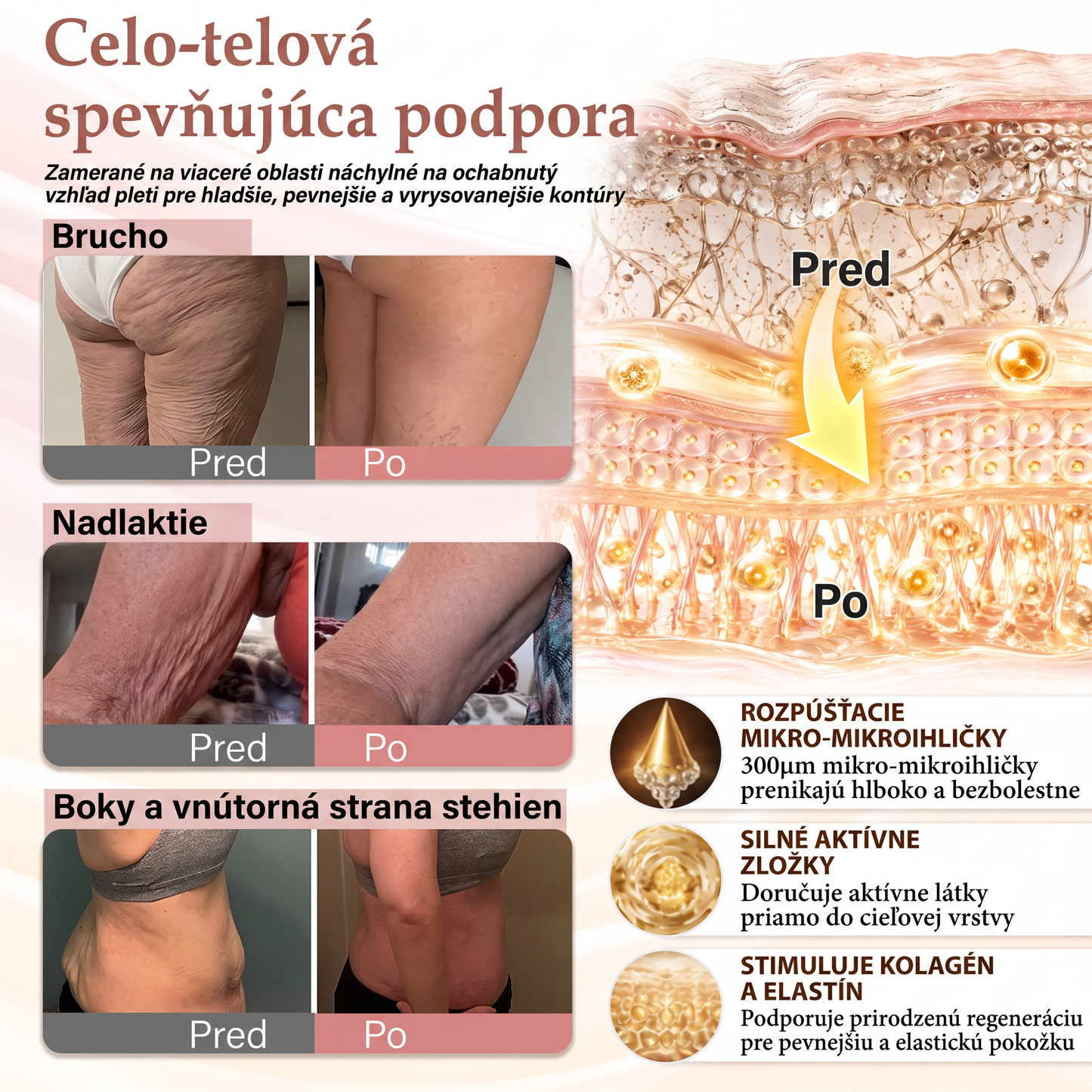💦HISKIN® Náplasti s mikroihličkami na zväčšenie objemu, spevnenie a lifting poprsia